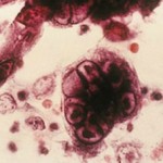 FOCUS ON: Viruses & Bacteria 