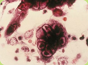 Focus On: Viruses & Bacteria