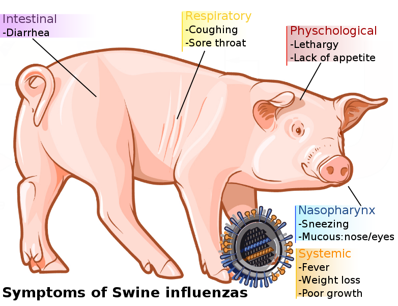 influenza symptoms