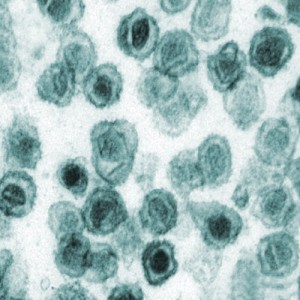 XMRV retrovirus