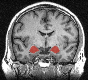 Meditation decreases gray-matter density in the amygdala