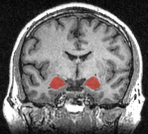 Left and right amygdala in brain