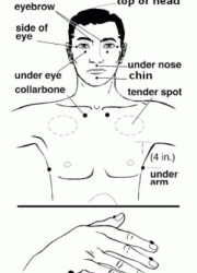 Emotional Freedom Technique (EFT) for MCS